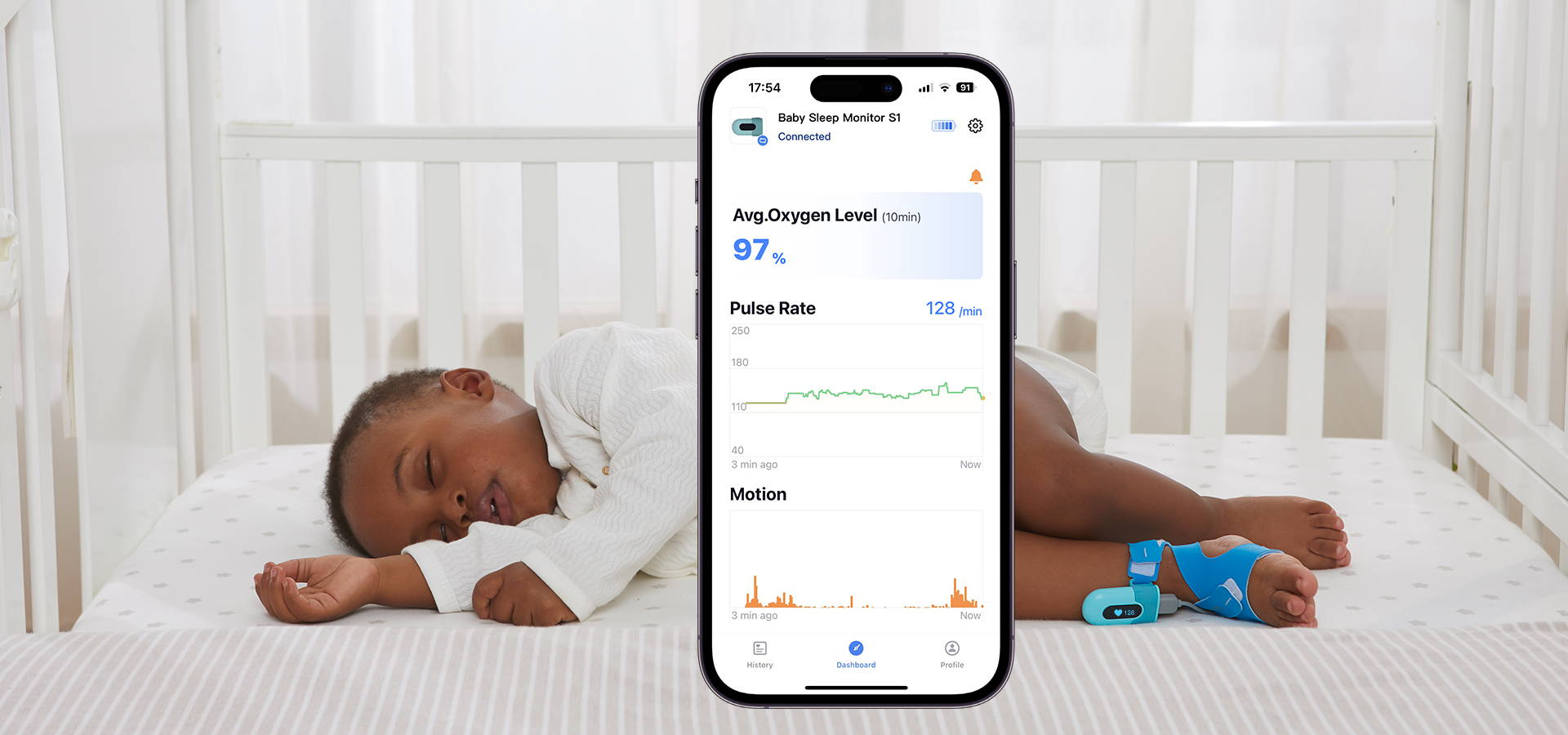 Babytone Accurate Infant Oximeter for Home Use